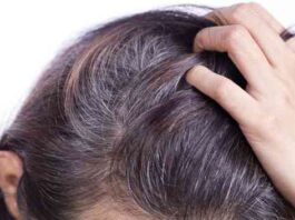 causes of white hair - Timesinsider.org